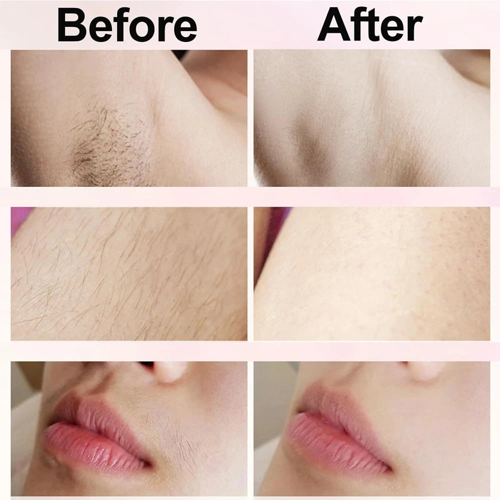 Electric Shaver for Women Portable Mini Rechargeable Epilator Female Painless Electric Razor Women'S Dual Head Bikini Trimmer